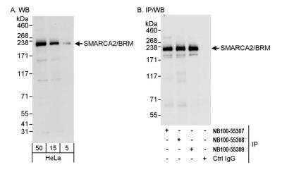 Western Blot: BRM Antibody [NB100-55308]