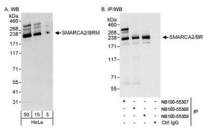 Western Blot: BRM Antibody [NB100-55307]