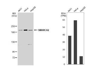 Western Blot: BRM Antibody [NBP3-13283]