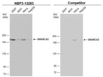 Western Blot: BRM Antibody [NBP3-13283]