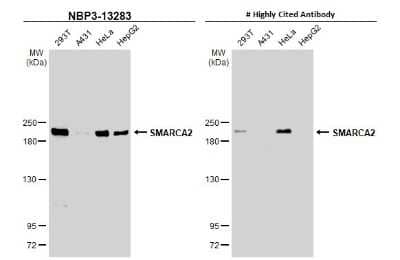 Western Blot: BRM Antibody [NBP3-13283]