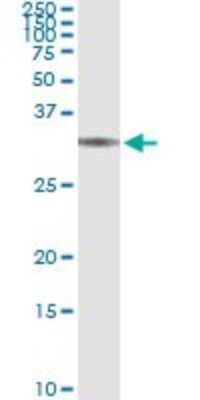 Immunoprecipitation: BRMS1 Antibody (2D4-2G11) [H00025855-M01]
