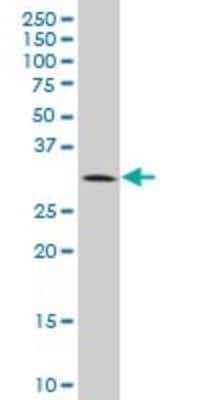 Western Blot: BRMS1 Antibody (2D4-2G11) [H00025855-M01]