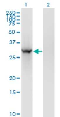 Western Blot: BRMS1 Antibody (2D4-2G11) [H00025855-M01]