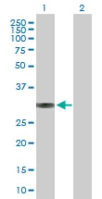 Western Blot: BRMS1 Antibody [H00025855-D01P]