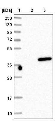 Western Blot: BRMS1 Antibody [NBP1-85090]