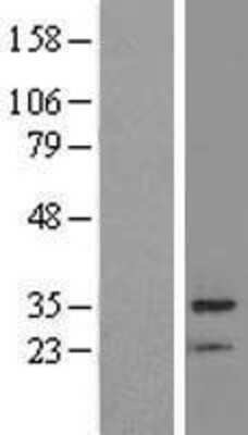 Western Blot: BRMS1 Overexpression Lysate [NBL1-08028]