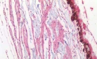 Immunohistochemistry-Paraffin: BRN3A Antibody [NBP3-14551]