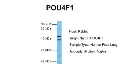 Western Blot: BRN3A Antibody [NBP2-83953]