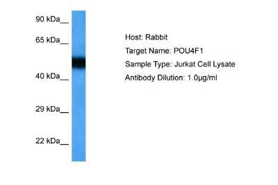 Western Blot: BRN3A Antibody [NBP2-83954]