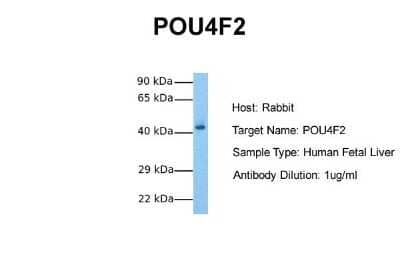 Western Blot: BRN3B/POU4F2 Antibody [NBP2-86585]