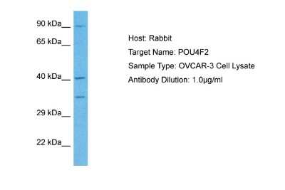 Western Blot: BRN3B/POU4F2 Antibody [NBP2-86585]