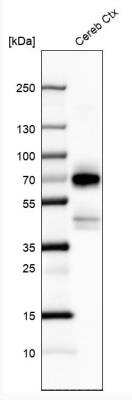 Western Blot: BRN4 Antibody [NBP1-89934]