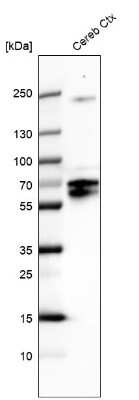 Western Blot: BRN4 Antibody [NBP2-68787]