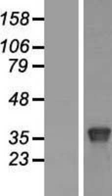 Western Blot: BRN4 Overexpression Lysate [NBP2-11147]