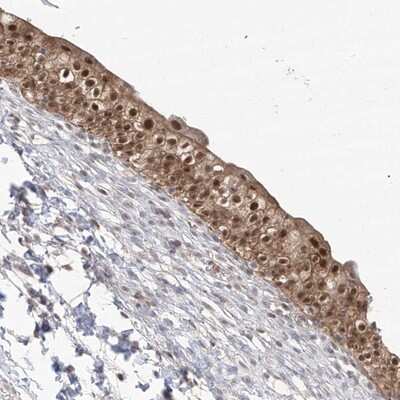 Immunohistochemistry-Paraffin: BROX Antibody [NBP1-90706]
