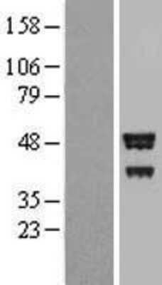 Western Blot: BROX Overexpression Lysate [NBP2-05533]