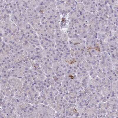 Immunohistochemistry-Paraffin: BRP44 Antibody [NBP2-31623]