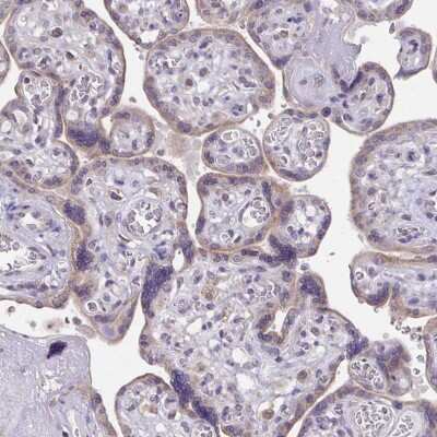 Immunohistochemistry-Paraffin: BRP44 Antibody [NBP2-31623]