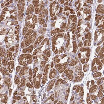 Immunohistochemistry-Paraffin: BRP44 Antibody [NBP2-31623]