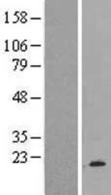 Western Blot: BRP44 Overexpression Lysate [NBP2-07178]