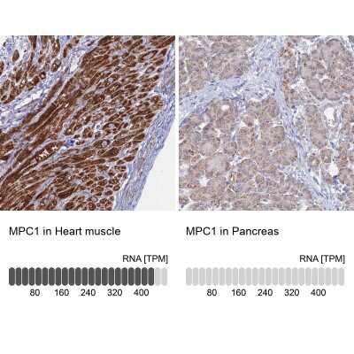 Immunohistochemistry-Paraffin: BRP44L Antibody [NBP1-91706]