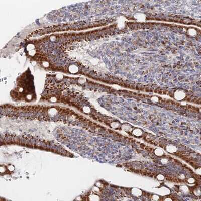 Immunohistochemistry-Paraffin: BRP44L Antibody [NBP1-91706]