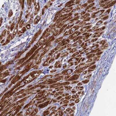 Immunohistochemistry-Paraffin: BRP44L Antibody [NBP1-91706]