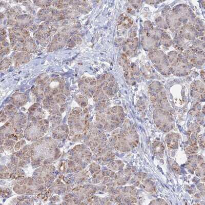 Immunohistochemistry-Paraffin: BRP44L Antibody [NBP1-91706]