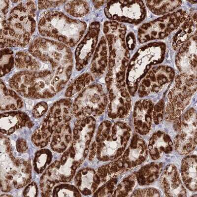 Immunohistochemistry-Paraffin: BRP44L Antibody [NBP1-91706]