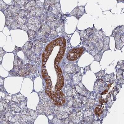 Immunohistochemistry-Paraffin: BRP44L Antibody [NBP1-91706]