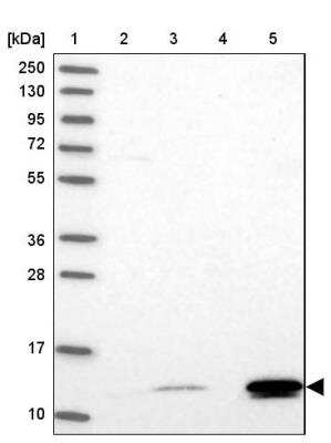 Western Blot: BRP44L Antibody [NBP1-91706]