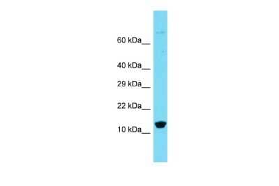 Western Blot: BRP44L Antibody [NBP3-10637]