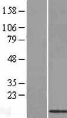 Western Blot: BRP44L Overexpression Lysate [NBL1-08030]