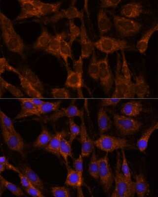 Immunocytochemistry/ Immunofluorescence: BRPF1 Antibody - Azide and BSA Free [NBP3-15510]