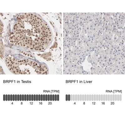 Immunohistochemistry-Paraffin: BRPF1 Antibody [NBP1-88369]