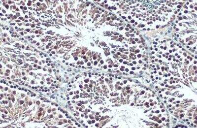 Immunohistochemistry-Paraffin: BRPF1 Antibody [NBP2-15620]