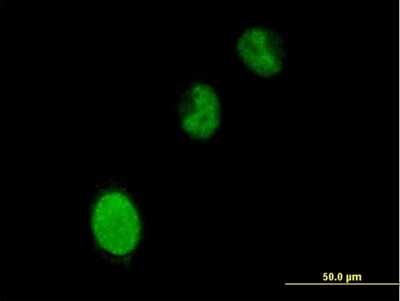 Immunocytochemistry/ Immunofluorescence: BRPF3 Antibody [H00027154-B01P]