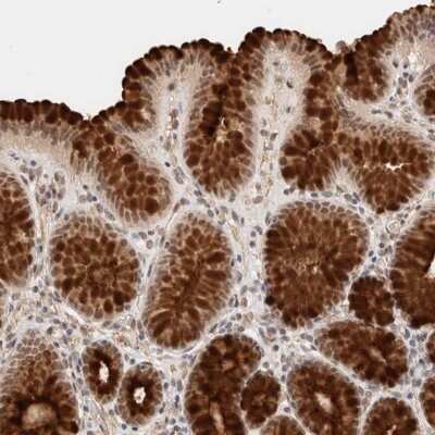 Immunohistochemistry-Paraffin: BRPF3 Antibody [NBP1-81419]