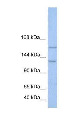 Western Blot: BRPF3 Antibody [NBP1-79382]