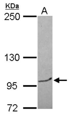 Western Blot: BRPF3 Antibody [NBP2-15621]