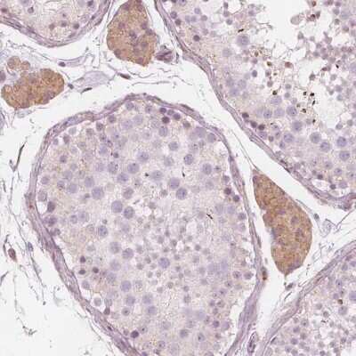 Immunohistochemistry: BRSK1 Antibody [NBP2-38935]