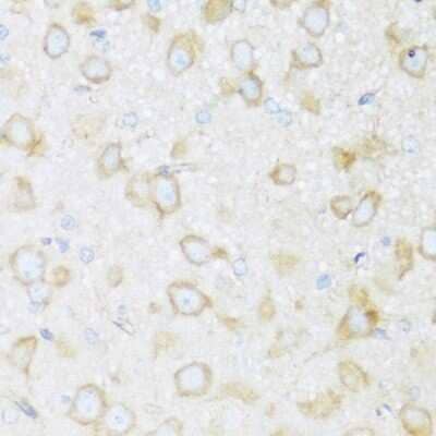 Immunohistochemistry-Paraffin: BRSK1 Antibody - Azide and BSA Free [NBP3-04952]
