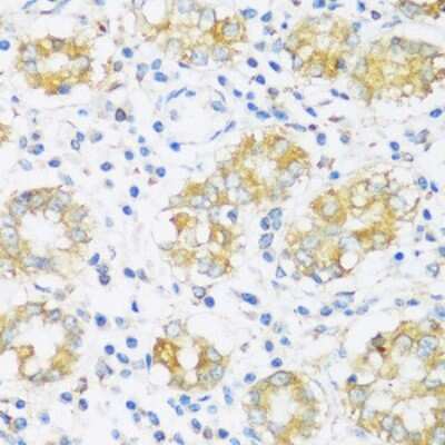 Immunohistochemistry-Paraffin: BRSK1 Antibody - Azide and BSA Free [NBP3-04952]