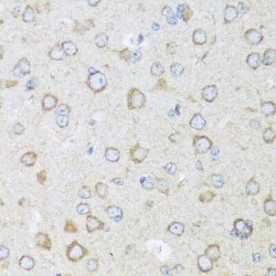 Immunohistochemistry-Paraffin: BRSK1 Antibody - Azide and BSA Free [NBP3-04952]