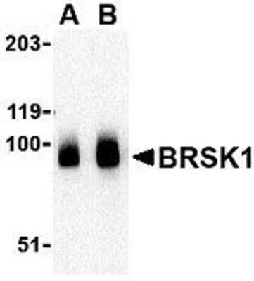 Western Blot: BRSK1 AntibodyBSA Free [NBP1-76778]