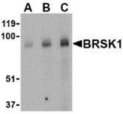 Western Blot: BRSK1 AntibodyBSA Free [NBP1-77280]