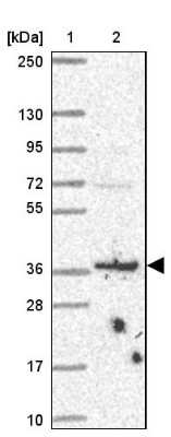 Western Blot: BRSK1 Antibody [NBP2-38935]