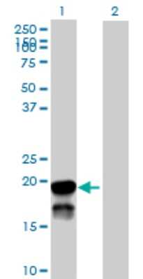 Western Blot: BRSK2 Antibody [H00009024-B01P]