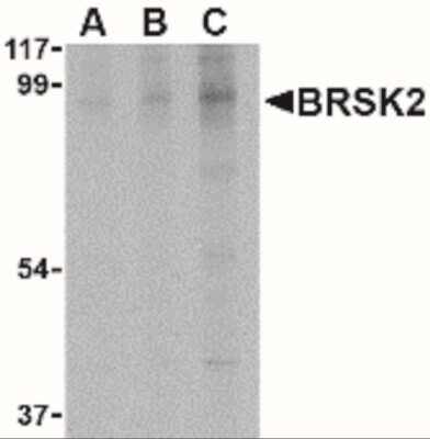 Western Blot: BRSK2 AntibodyBSA Free [NBP1-77281]